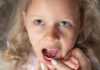 What To Do About a Loose Baby Tooth