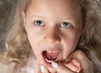 What To Do About a Loose Baby Tooth